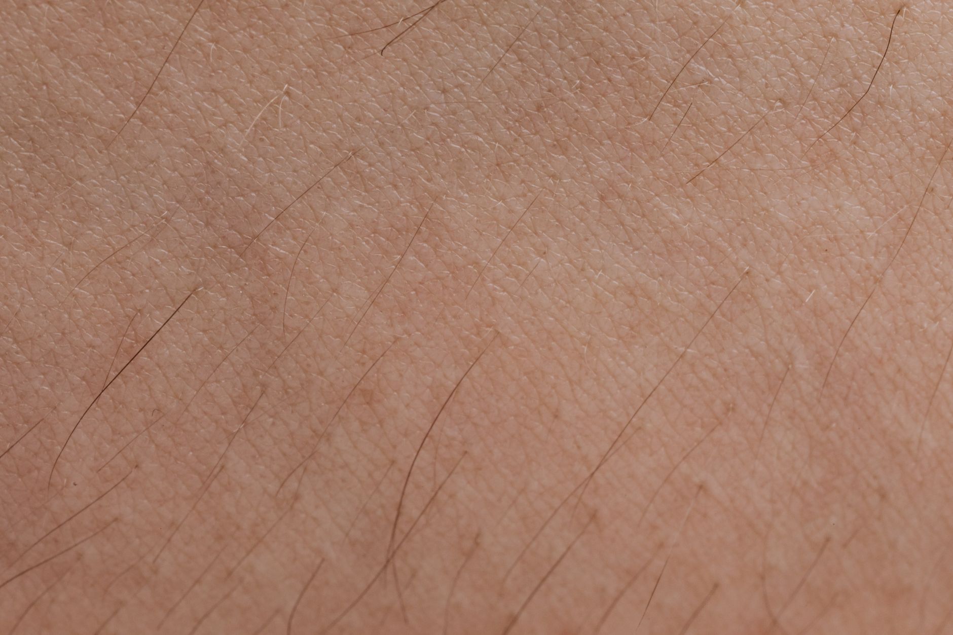 Zbliżenie na przedramię z włókniakami, sygnał zaburzeń metabolicznych